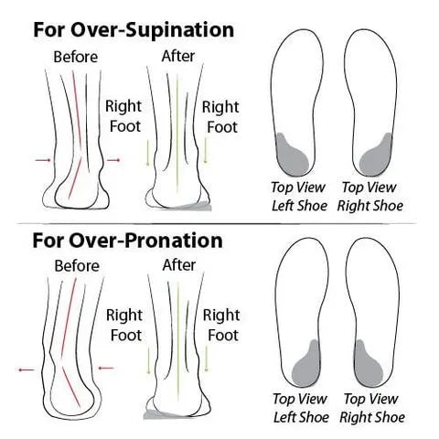 Engraved Comfortable Chunky Heel Sandals ( BUY 2 FREE SHIPPING )